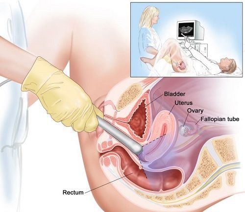 Các dịch vụ siêu âm phụ khoa tại MEDLATEC đảm bảo an toàn, nhanh chóng và chính xác.