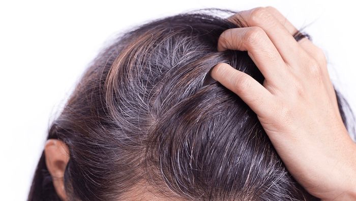 Thiếu melanin làm tóc bạc sớm