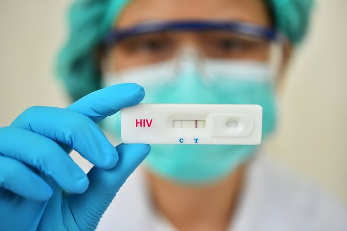 Khi nghi ngờ mắc HIV, cần thực hiện xét nghiệm chẩn đoán ngay lập tức