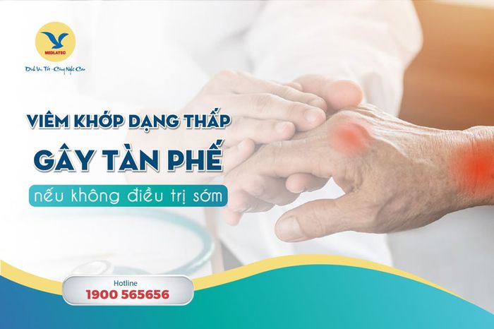 Bệnh viện Đa khoa MEDLATEC có kinh nghiệm trong việc điều trị bệnh viêm khớp dạng cấp.