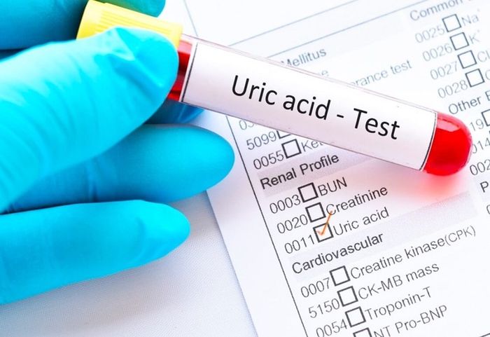 Thực phẩm ảnh hưởng đến mức độ axit uric trong máu