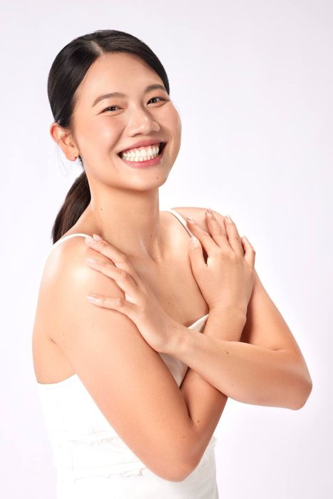 Ánh Viên có ngoại hình được cải thiện sau khi niềng răng