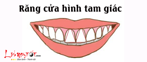 Tướng răng cửa tiết lộ bản chất con người thực sự của bạn trong hình ảnh gốc