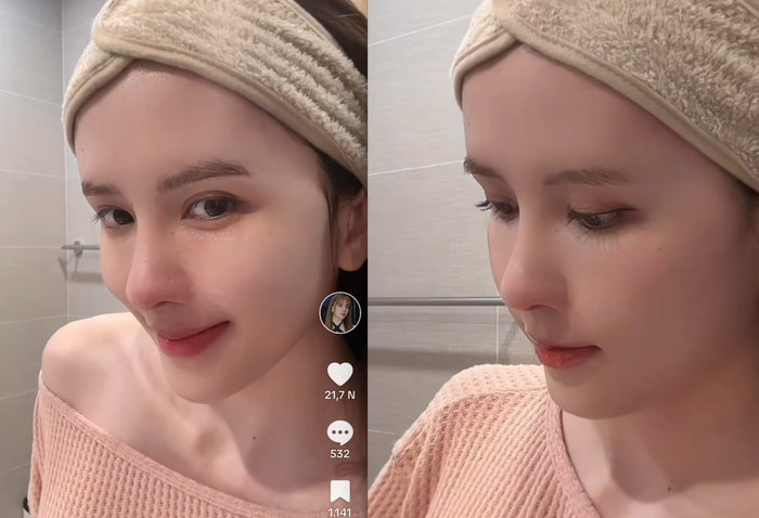 Nghi ngờ về việc Thiều Bảo Trâm đã sửa mũi