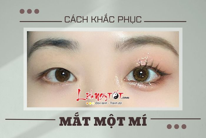 Giải pháp cho mắt bị mí một bên