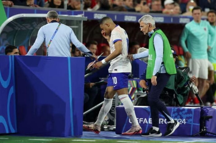 Sự cận cảnh về chấn thương gãy mũi của Kylian Mbappe 482746