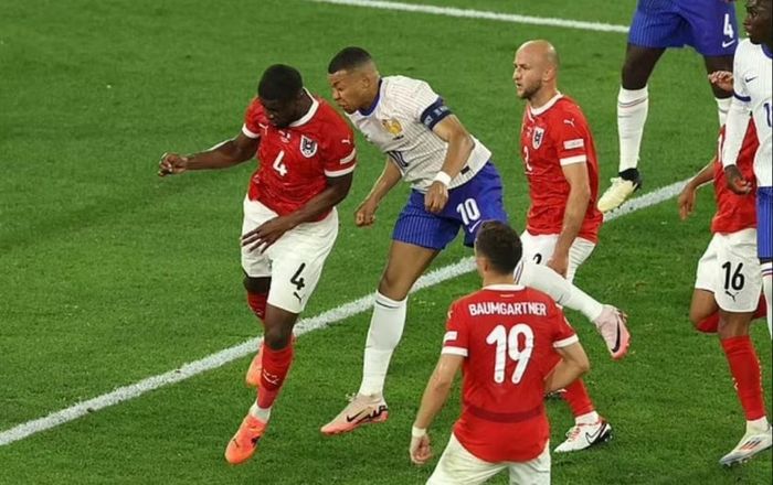 Sự cận cảnh về chấn thương gãy mũi của Kylian Mbappe 482735