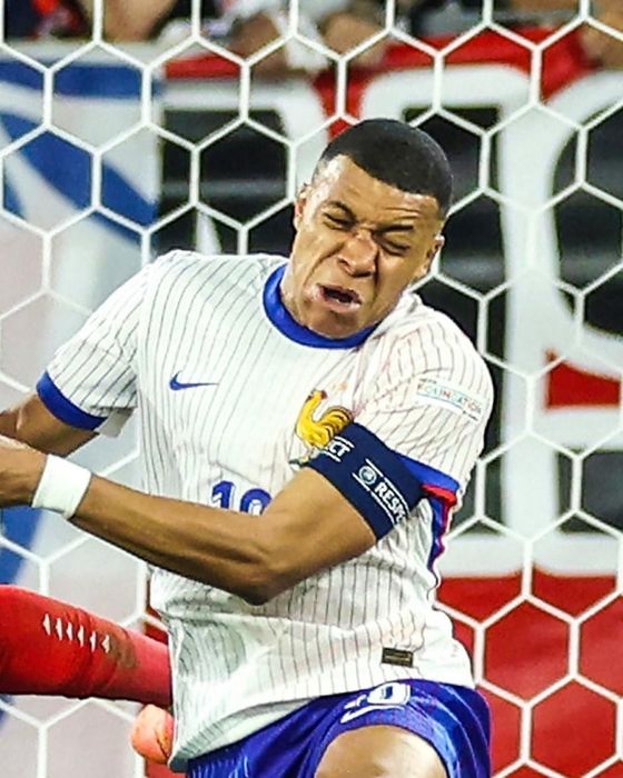 Cận cảnh về chấn thương gãy mũi của Kylian Mbappe 482750