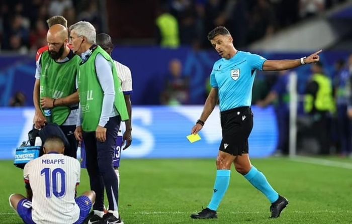 Sự cận cảnh về chấn thương gãy mũi của Kylian Mbappe 482737