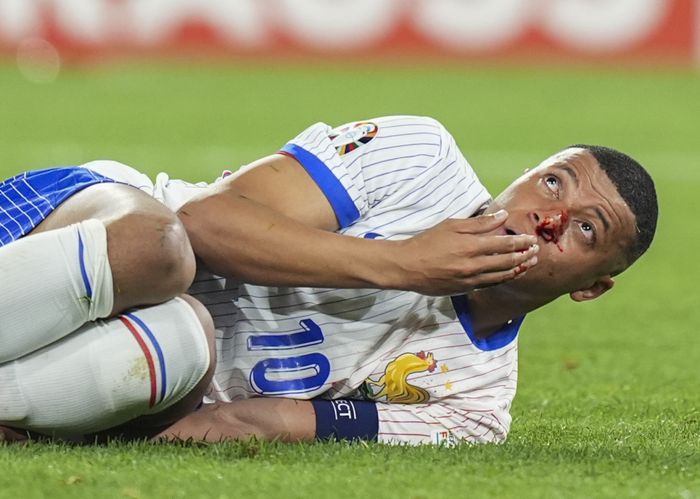 Mbappe bị vỡ mũi, phải vào viện ngay sau trận đấu mở màn Euro 2024
