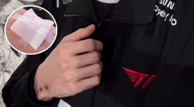 Mặc dù vẫn đang phục hồi từ chấn thương nhưng Faker vẫn tỏa sáng.