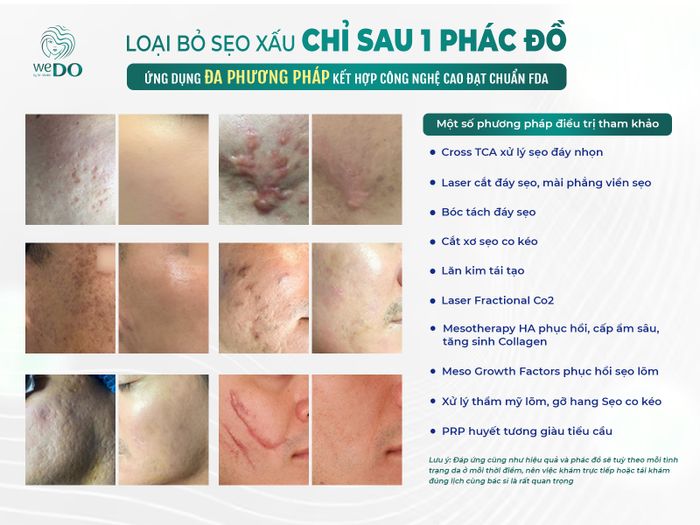 loai bo seo xau.jpg