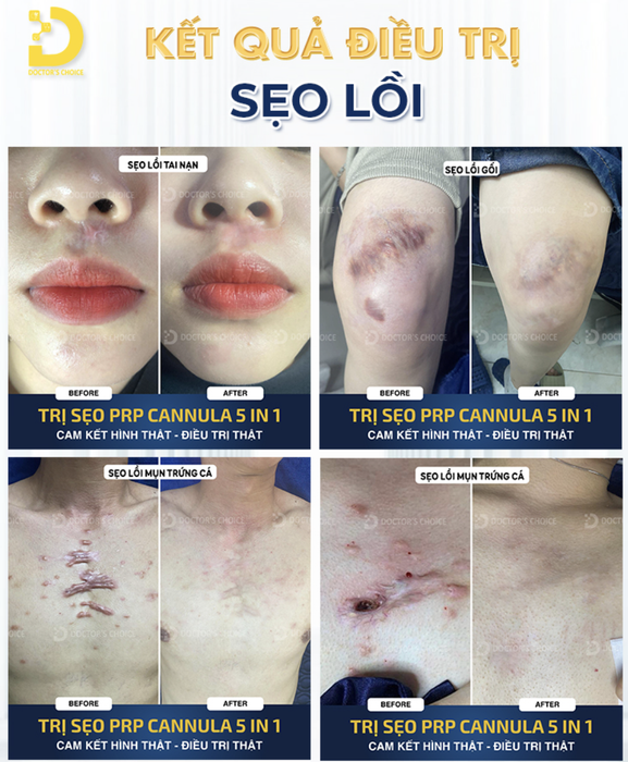 dr choice tri seo loi 2.png