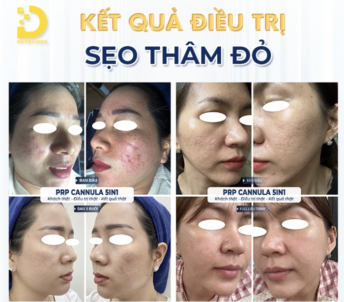 dr choice tri seo loi 4.png