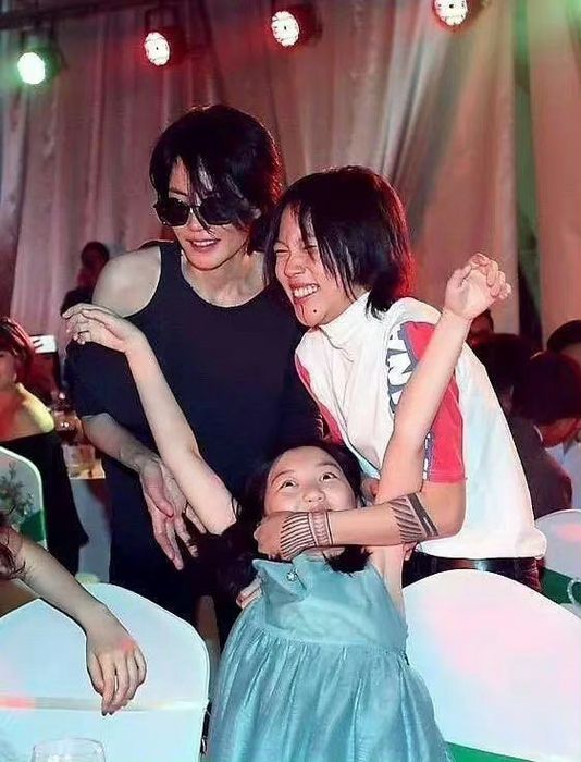 Con gái của Lý Á Bằng và Vương Phi đã phẫu thuật để khắc phục tật sứt môi và hàm ếch.