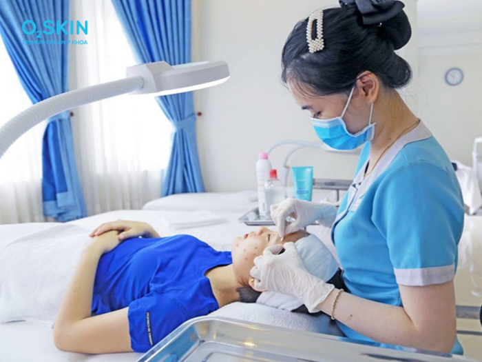Điều dưỡng O2 SKIN đang thực hiện việc lấy nhân mụn chuẩn y khoa bằng tăm bông vô khuẩn cho khách hàng.