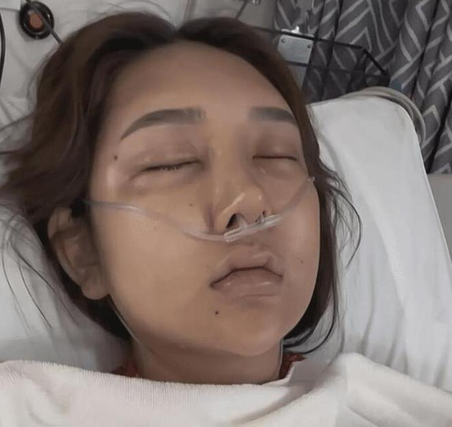 Streamer nữ chi 8 tỷ để thực hiện giấc mơ sắc đẹp và kết cục đầy bi kịch!