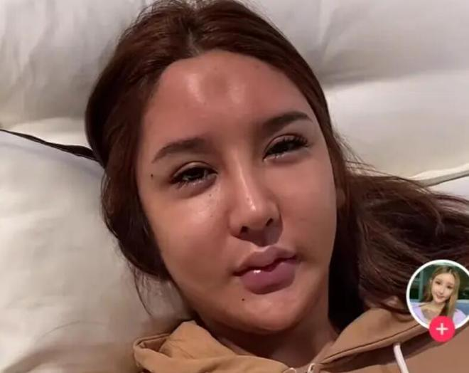 Streamer nữ chi 8 tỷ để thực hiện giấc mơ sắc đẹp và kết cục đầy bi kịch!