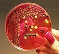 Vi khuẩn Salmonella trong môi trường nuôi cấy nghiên cứu