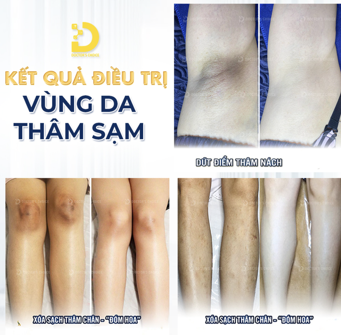 dr choice clinic tri tham 2.png