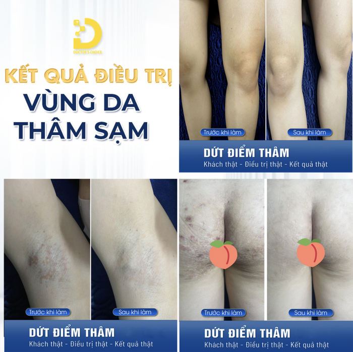 dr choice clinic tri tham 4.png