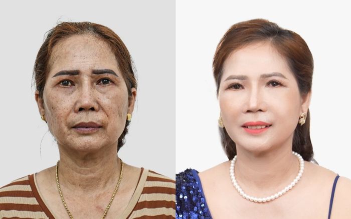 Viện thẩm mỹ KangJin mang đến cơ hội cho nhiều phụ nữ 'trẻ lại' hoàn toàn miễn phí