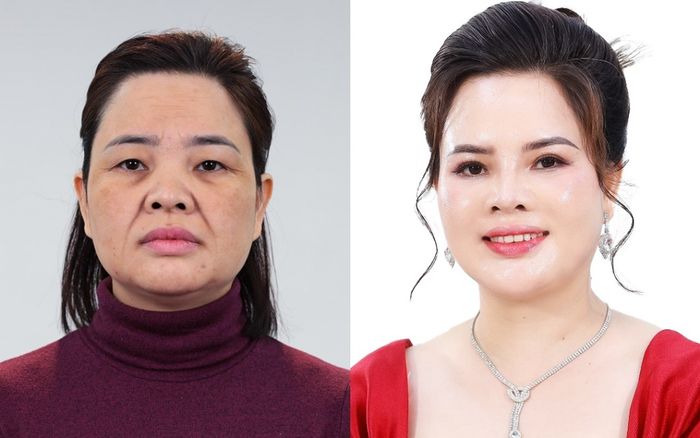Viện thẩm mỹ KangJin mang đến cơ hội cho nhiều phụ nữ 'trẻ lại' hoàn toàn miễn phí