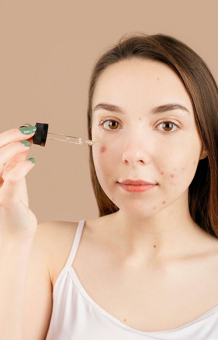 Mụn bọc và các phương pháp điều trị