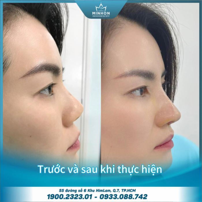 Hình ảnh Phòng Khám Thẩm Mỹ MINHON Plastic Surgery 2