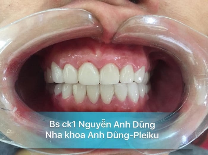 Hình ảnh Nha Khoa Anh Dũng 2