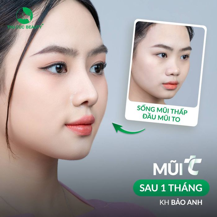 Hình ảnh Bệnh viện thẩm mỹ Thu Cúc 2