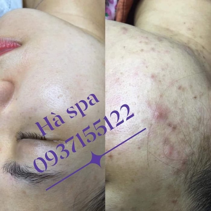 Hình ảnh 2 của Hà Spa