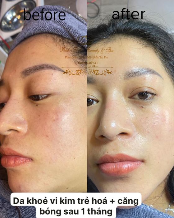 Ảnh 1 của Bích Tuyền Beauty & Spa