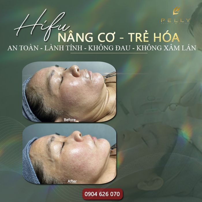 Ảnh 2 của PELLY BEAUTY & HEALTH
