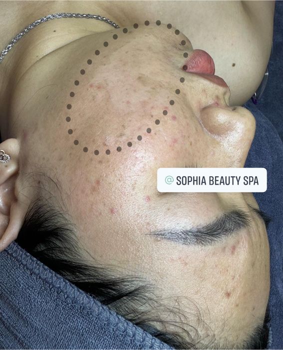 Hình ảnh 3 của Sophia Beauty Spa