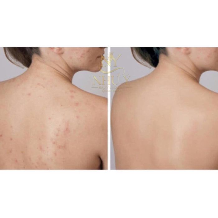 Hình ảnh 3 tại Như Ý Spa