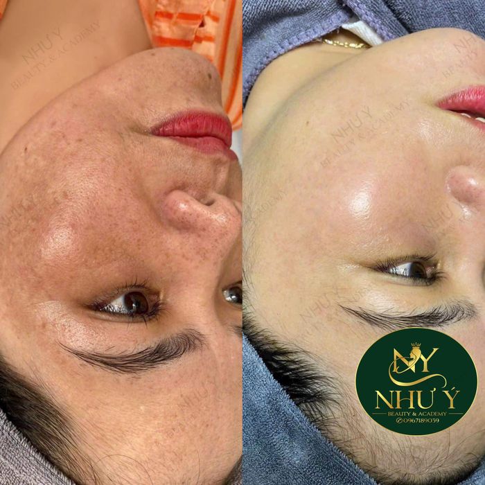 Hình ảnh 2 tại Như Ý Spa