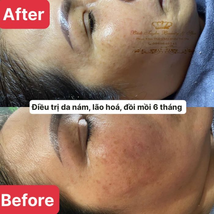 Ảnh 2 của Bích Tuyền Beauty & Spa