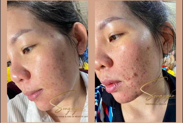 Hình ảnh 1 của Song Ngân Beauty Spa