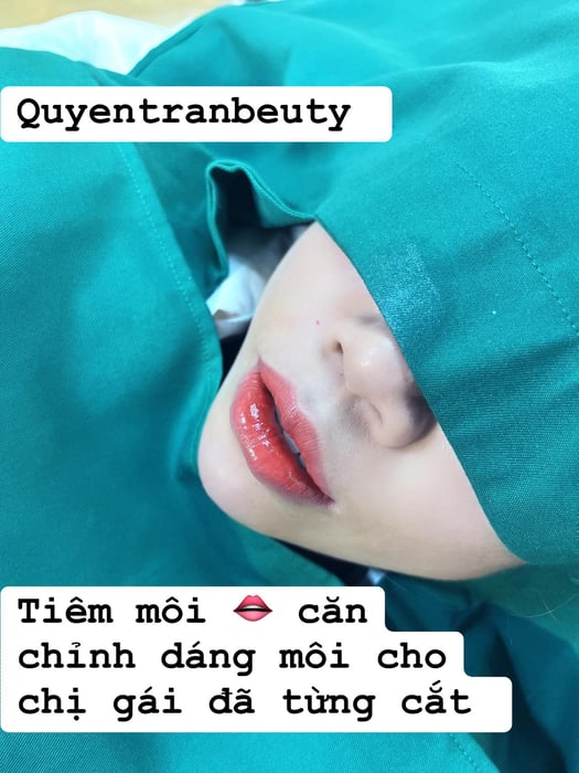 Hình ảnh Quyên Trần Beauty 2