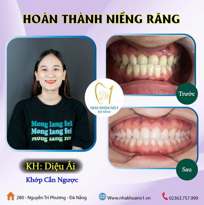 Hình ảnh 2 của Nha Khoa NO1 Đà Nẵng