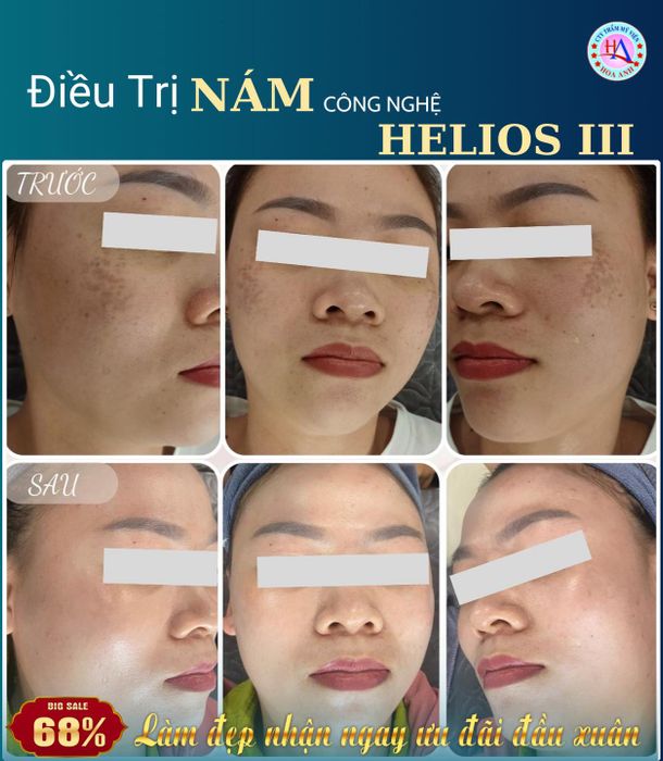 Ảnh 2 của Thẩm Mỹ Viện Hoa Anh