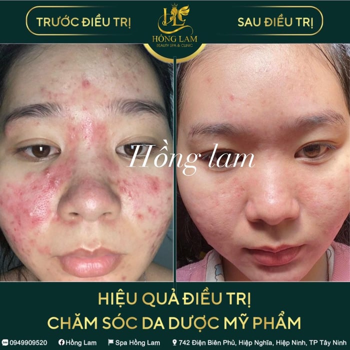 Spa Hồng Lam hình ảnh 2