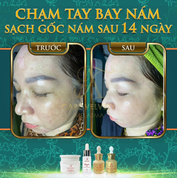 Ảnh Kim Ngân Spa