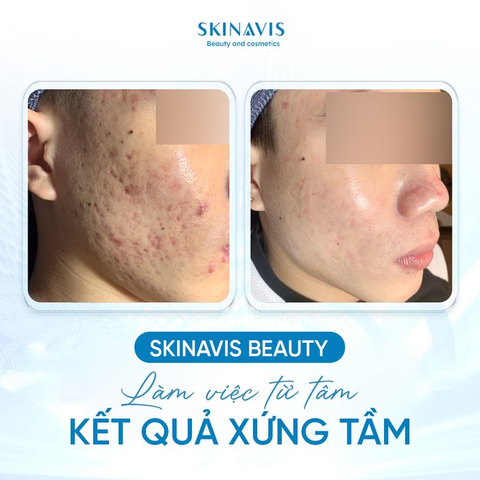 Hình ảnh 1 của Skinavis Beauty