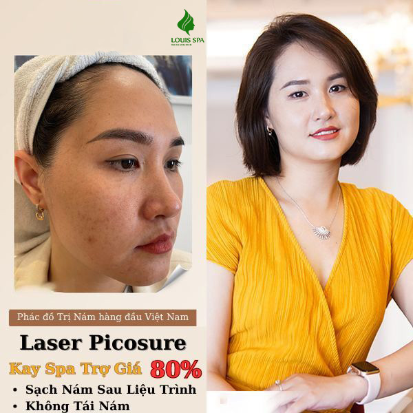 Hình ảnh LOUIS SPA KON TUM - Viện Thẩm Mỹ Công Nghệ Cao 1