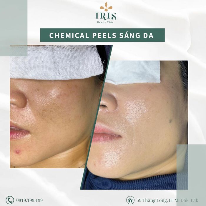 Hình ảnh 1 tại IRIS Beauty Clinic