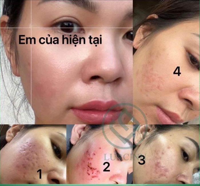 Hình ảnh Ngà Beauty Spa 1