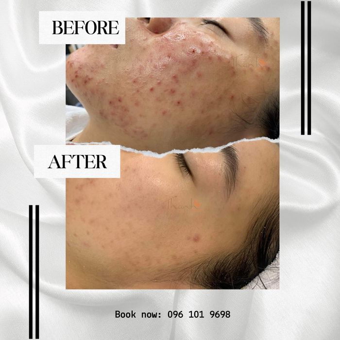 Hình ảnh 1 của Thanh Skin Spa