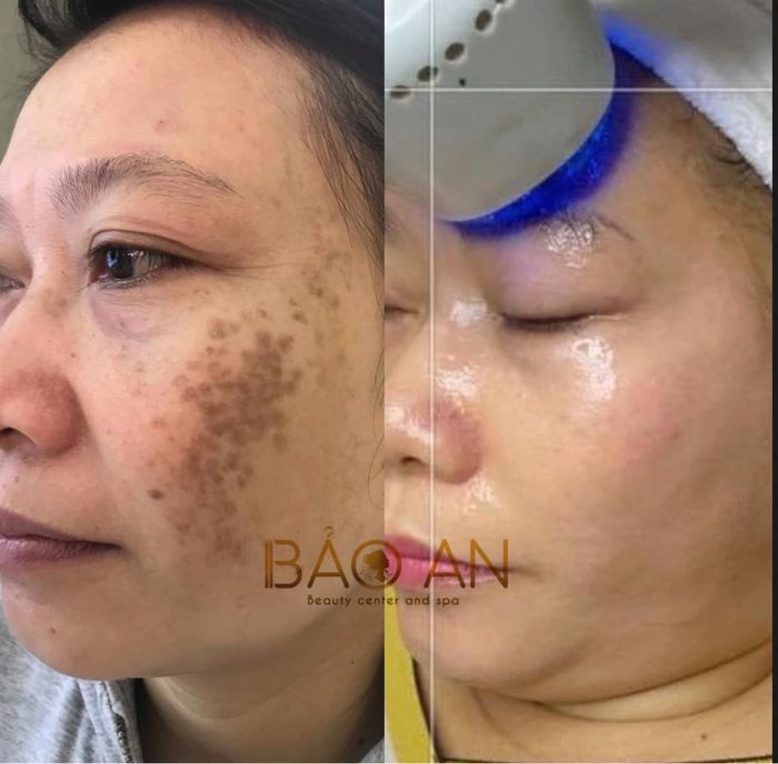 Hình ảnh Thẩm mỹ Bảo An số 1